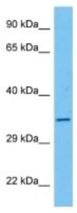 ITF46 Rabbit anti-Rat, Polyclonal, Novus Biologicals 100 &mu;g | Buy Online | Novus Biologicals | Fisher Scientific